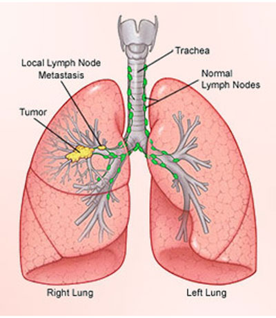 Lungs